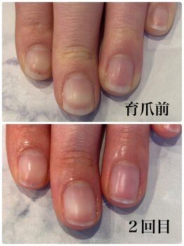 ネロリ(Neroli)/医療従事者でも育爪出来ます◎