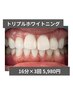 【効果重視No.1◇48分集中】ホワイトニング16分×3回 14940円→5980円