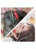 【人気セット】小顔・肌質改善★美容鍼＋鍼でヘッドスパ　￥17600→￥12000