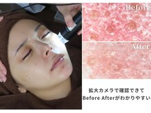  ミニョスキンラボ【韓国肌管理・毛穴改善・ハーブピーリング】【10/15OPEN（予定）】の雰囲気（恵比寿/フェイシャル/毛穴洗浄/ニキビケア/ララピール/LDM/韓国）