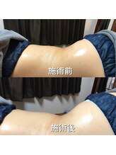 リラクゼーションサロン カネサチ/ダブルキャビ