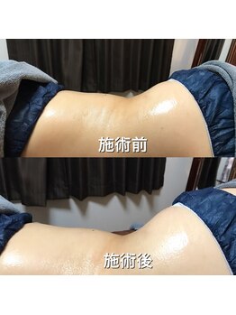 リラクゼーションサロン カネサチ/ダブルキャビ