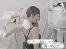ツドイ(TSUDOI)/背中やうなじの脱毛