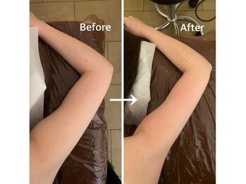 ビュール 銀座(BeauL)/ブライダルエステ