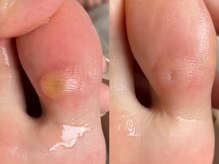 キラネイル アンド アイラッシュ by World Beauty(KIRA)/#新潟フットケア