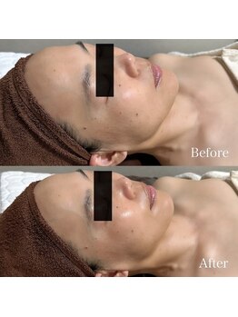 エレーナ(ELENA)/フェイシャルベーシックコース