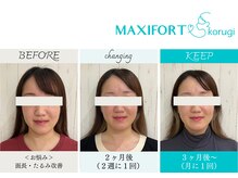 マキシフォート 名駅店(Maxifort)/お客さまからの感想