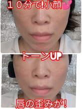 ヨサパーク アエル(YOSA PARK AELL)/小顔/美肌/ヘッド/矯正/整体