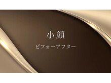 ペリー(PELLY)/小顔