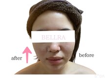 ベルラ(BELLRA)の雰囲気（小顔◆メスを使わない最強小顔施術で自分史上最高の小顔へ★）