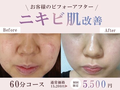 エミュ(emu)の写真