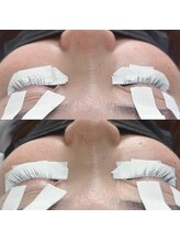 アルビス バイ エニーハウ(Arbis by anyhow)/パーマ落とし（マツパ）