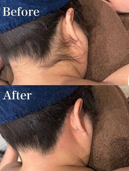 ジョエルワックス 沖縄那覇店(JOELLE WAX)/Wケアでうなじのお手入れ♪