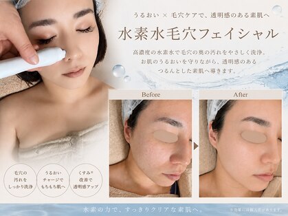 デイジー(Daisy)の写真