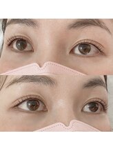 リボーテ(Reboaute)/アップフォースリフト