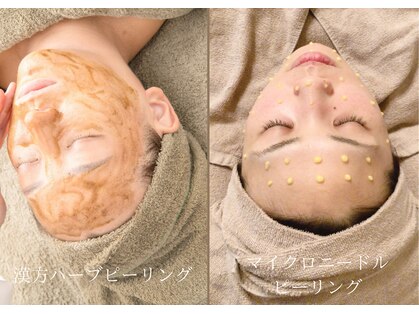 アルム(Arum)の写真