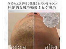 キレイラボ(Ki-Re-i LABO)の雰囲気（脱毛などメニューの仕上がりの詳細はブログをご覧ください♪）