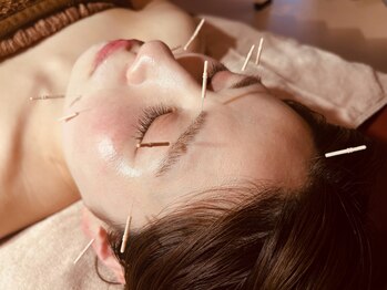 癒縁(YOU enn)の写真/気軽に来れるアットホームなお店◎顔の構造を熟知している施術者によるフェイシャル&美容鍼施術♪