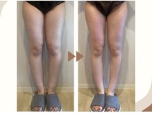 リングケー(Ling K)/スリムショック