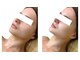 スカイアンドシー(sky&sea)の写真/比べてみて！「ここでしか体験できない」最先端マシン×プロの施術◎人にお披露目したくなる美肌へ♪