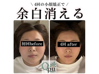 キュープ 富士店(Qpu)の写真/左右差、浮腫み、凝りを改善、お顔全体を整えます。施術の効果で「痩せた?」「イジった?」と聞かれる方も