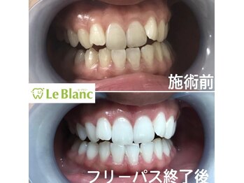 ルブラン 奈良店(Le Blanc)/お早めのご予約を!