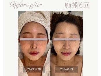 パルタージュ(Partage)/