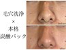 メンズ【毛穴汚れ&テカリ肌徹底ケア】毛穴洗浄ハイドロコース12100→8470