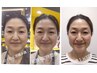 ハリ艶・小顔！♪【高濃度美容液導入＆顔首肩デコルテマッサージ付】15800円