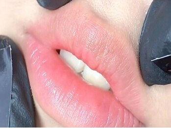 ビアル(VIALU)の写真/ローマピンク同等の美白力！希少導入《ドールピンク》で透明感ケア