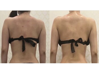 シャルム(CHARME)/ブライダルエステ