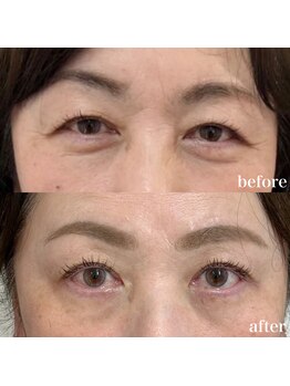 クレール(clair)/アイパワーエステ