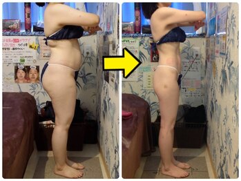 美容エステサロン ヴィアージュ 王子店(Viage)/復職に向けてダイエット成功!