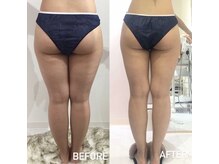 エスグレース 梅田店(S.grace)/