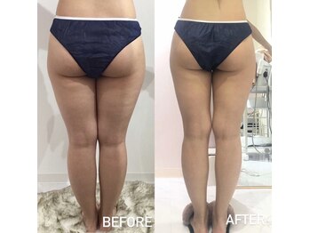 エスグレース 梅田店(S.grace)/