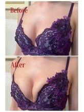 エステティックサロン パヒューム(Esthetic Salon Perfume)/before - after