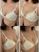 プレフィール(PLEAFEEL)/