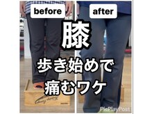 カワル整体 上通り院/歩き始めで痛むワケ
