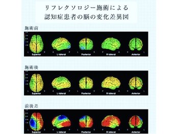 ホットちょっと 南船橋店(HOTちょっと)/リフレクソロジーによる脳の変化
