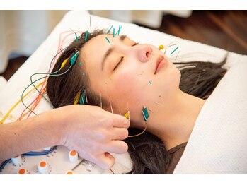 しらゆき堂鍼治療院/電気を流す美容鍼