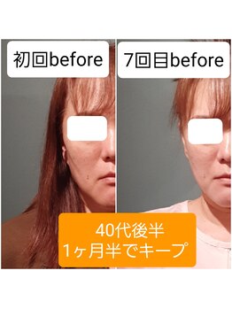 エルアンドエス(L&S)/1ヶ月半1週間に1回の短期集中