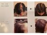 《男性利用可》特許取得!最先端★育毛促進装置(越谷市では当店のみ!)33分