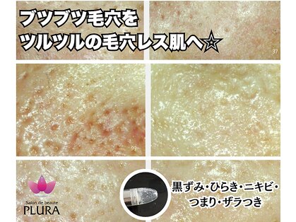 サロン ド ボーテ プルーラ(Salon de beaute PLURA)の写真