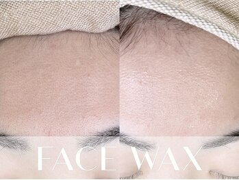 アイアンドネイル ブライト(bright)の写真/フェイスwaxでツルン肌へ！ワントーン明るい肌でメイクのりも良く◎