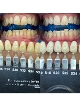 トウキョウスワーズ 池袋店(TOKYO SWRS)/#ホワイトニング #池袋 #渋谷