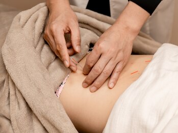 はりきゅうすず風の写真/赤ちゃんからご年配の方まで一人一人の身体の状態・不調の原因を見極め健康になるお手伝いをいたします◎