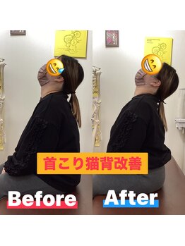 ヒデ整体院(Hide整体院)/猫背矯正骨盤矯正B/A肩こり腰痛