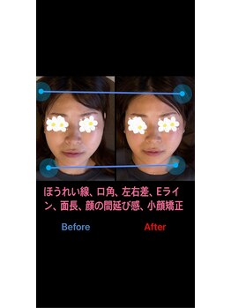 美容矯正サロン レレポノ(LELEPONO)/