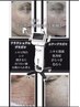 【プラズマフェイシャル登場】全顔エアートライアル通常¥20,900→¥13,200