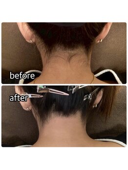 アイリス(Iris)の写真/【ブライダルの方におすすめ】後ろ姿を綺麗に魅せたい方!WAX脱毛で産毛ケア☆透明感のある素肌に導きます♪